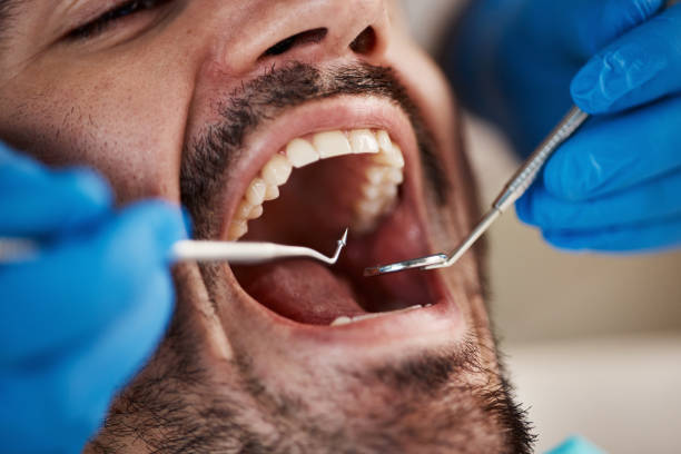 Best Emergency Cosmetic Dentistry (e.g., broken veneers) in Little Canada, MN